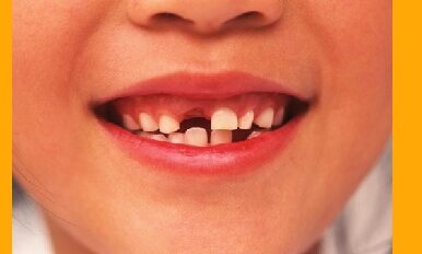 Le cycle de la dentition, des dents de lait aux dents définitives