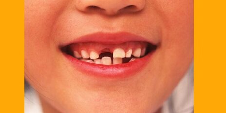 Le cycle de la dentition, des dents de lait aux dents définitives
