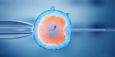 Qu’est ce que la Fécondation In Vitro ?
