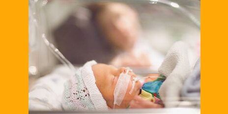 Comment accepter une naissance prématurée ?