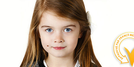 Les grains de beauté chez l'enfant